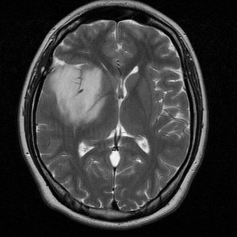 томография головного мозга в крыму